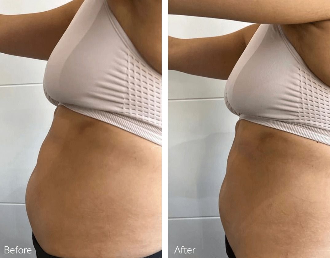 Before and after body transformation comparison.