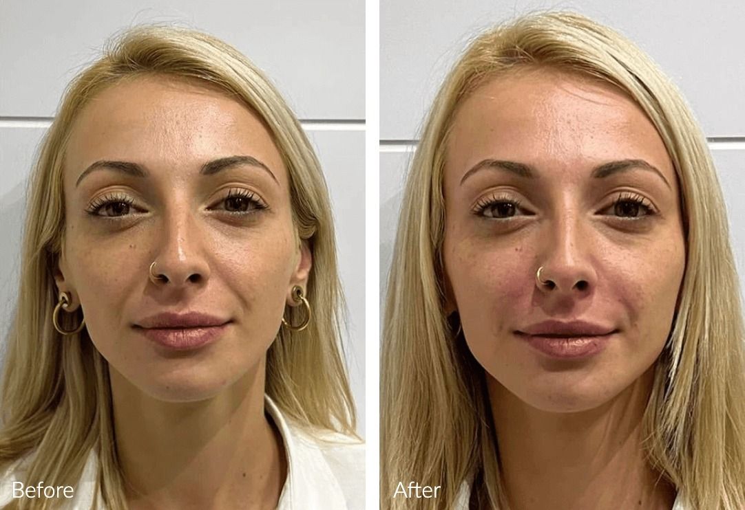 Before and after facial transformation comparison.