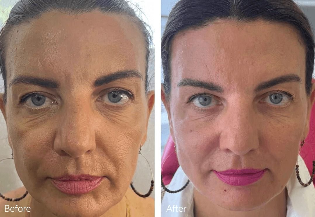 Facial transformation before and after treatment.