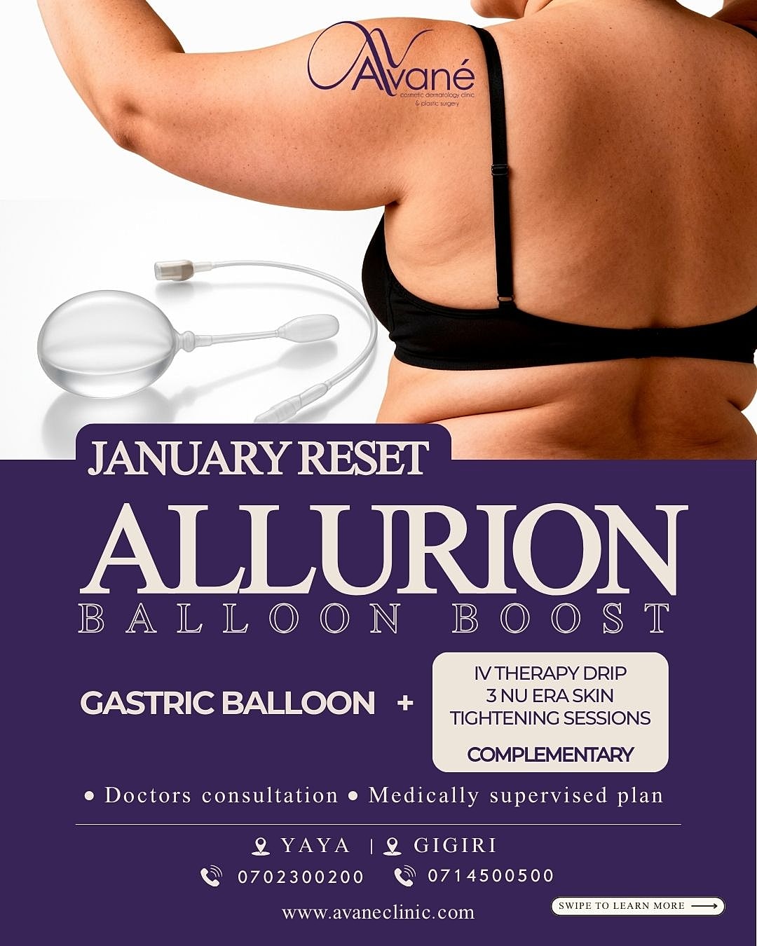Gastric balloon promotional image for weight loss.