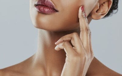 Chemical Peel in Nairobi Kenya