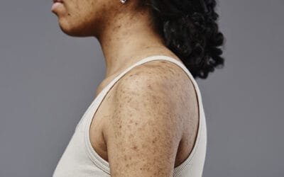 Diseases Treated by a Dermatologist.