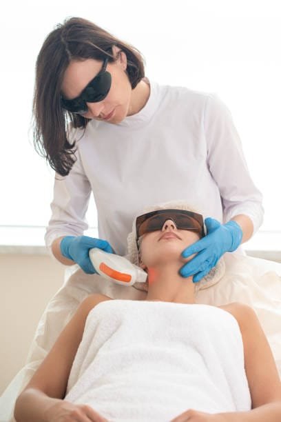 Laser for spots removal treatment Laser for spots removal treatment