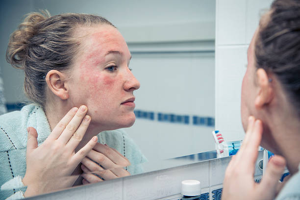 Eczema Treatment: How Is the Condition Managed?