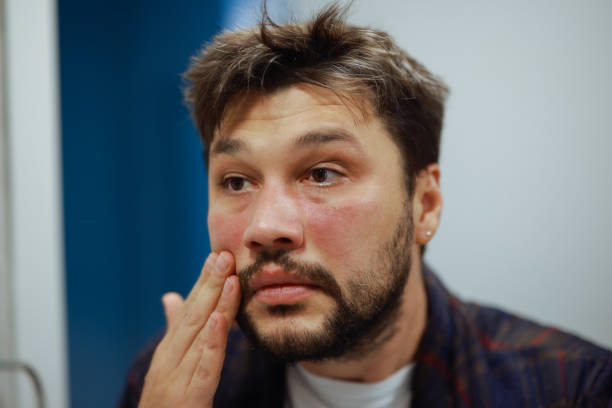 the condition can often be controlled with the right treatment and ongoing skin care.