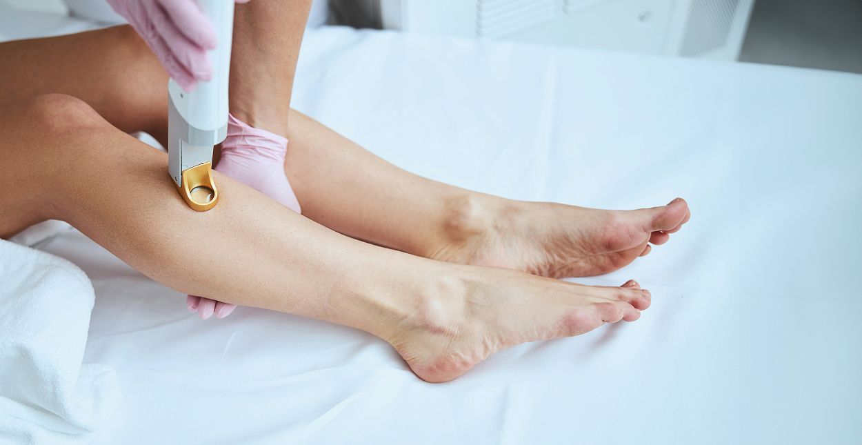 Woman receiving laser treatment on her legs.