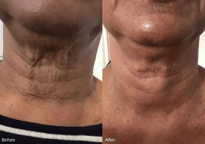 Model showcasing hoop earrings and natural makeup.