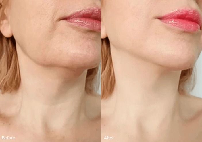 Smiling woman with curly hair and glowing skin.